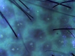 -雍禾植发全国连锁