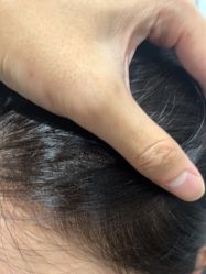 -熙朵美学植发连锁