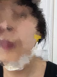 体验前-杭州奥拉克医疗美容门诊部