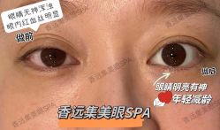 -LUNA皮相美·骨相美高级美感