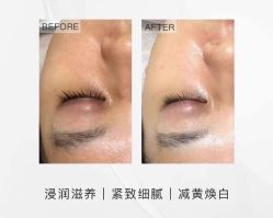 -LUNA皮相美·骨相美高级美感