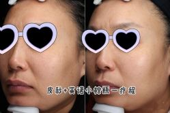 -上海漾颜医疗美容