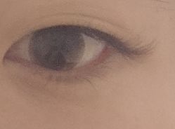 体验后-LEYA皮肤管理