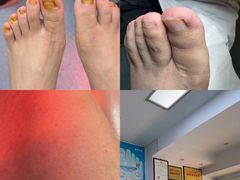 -新甲连锁灰指甲·甲沟炎·鸡眼(黑龙江路店)