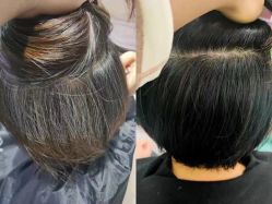 点击看大图 -舒欣头疗·俏丝谧语 白发脱发专业护理