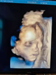 -重庆安琪儿妇产医院-妇幼保健联盟医院