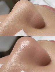 -Younger Skin·科技氧肤中心
