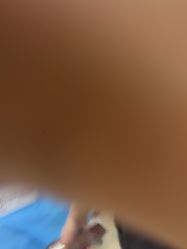 -东莞壹加壹整形美容医院