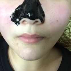 -痘院士祛痘美容皮肤管理