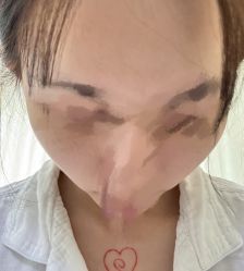 体验前-上海首尔丽格医疗美容医院