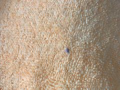 -陕西紫康专业修脚房(园岭八街店)