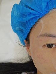 体验后-深圳阳光医疗美容