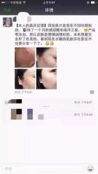 英树玻尿酸羊胎素化妆品-英树玻尿酸羊胎素专营化妆品