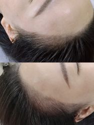 点击看大图 -西施无菌半永久纹绣眉眼影唇轻增发纹发际线