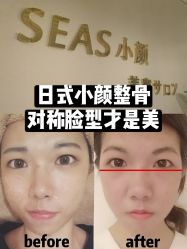 -SEAS小顏·日本小颜整骨美容サロン