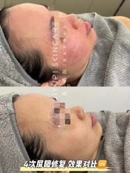 -MLP美丽派·问题肌疗愈中心
