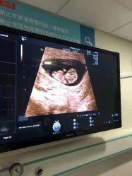 -杭州贝瑞斯美华妇儿医院·早孕·产检·儿科