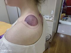 -沈师傅盲人按摩工作室(密三小区店)