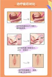 点击看大图 -伊丽莎白医疗美容