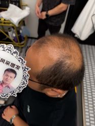 -唐风采假发补发定制