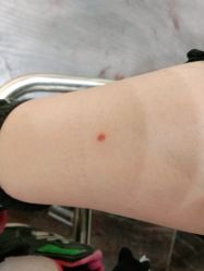 体验后-JS医疗美容