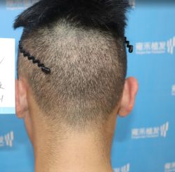 -雍禾植发全国连锁