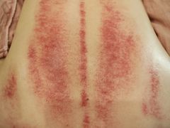 -艾通康缘艾灸.疼痛.睡眠养生馆(凤凰城店)