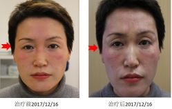 -丰联丽格医疗美容·联合丽格眼整形中心