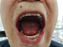 -极光口腔·矫正种植修复(锦江院区)