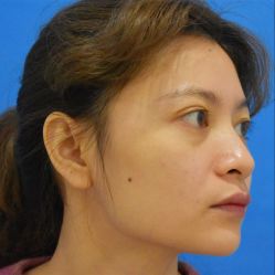 -天津健丽·去眼袋医疗美容机构