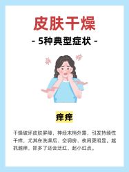 -克丽缇娜