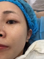 体验前-郑荃丽格医疗美容