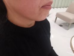 -Yestar艺星整形美容医院