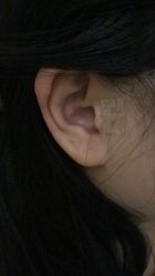-肥三针腧穴瘦身馆