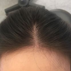 -章光101防脱养发荟