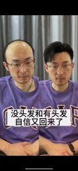 -唐风采假发补发定制