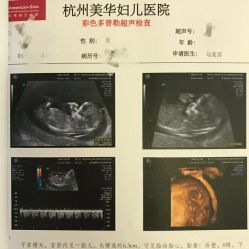 -杭州贝瑞斯美华妇儿医院·早孕·产检·儿科