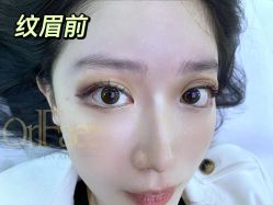 点击看大图 -OnFaer.纹眉半永久无创洗眉
