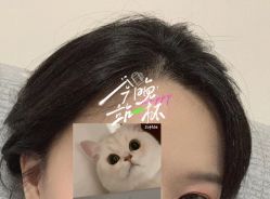 -大麦微针植发全国连锁