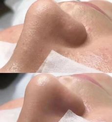 -美肤盾祛痘·问题肌头疗管理中心