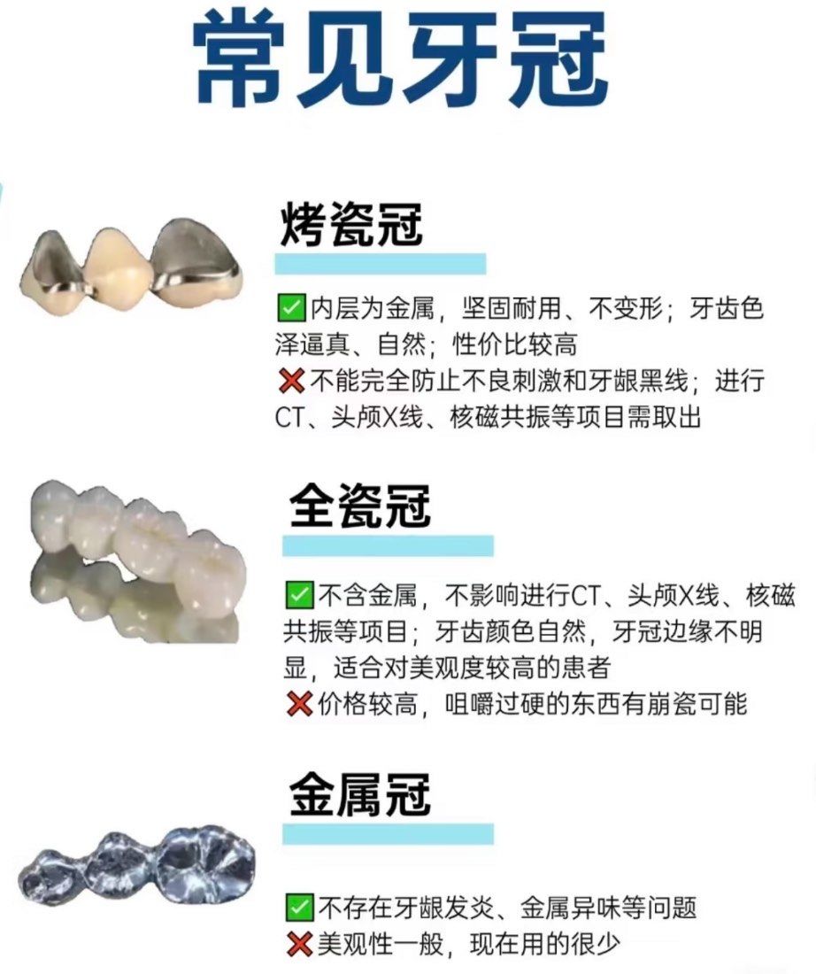 烤瓷牙or全瓷牙