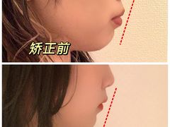 -极光口腔·矫正种植修复(锦江店)