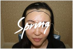 -大麦微针植发全国连锁