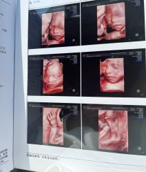 -杭州贝瑞斯美华妇儿医院·早孕·产检·儿科