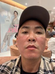 点击看大图 体验后-深圳艺星医疗美容医院