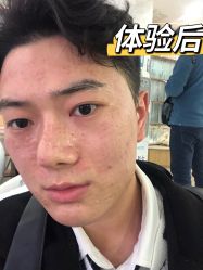 体验后-重庆联合丽格第五医疗美容医院