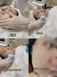 -柠檬一美·Ondapro·轻薄紧致抗衰中心