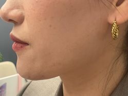 -长沙雅美医疗美容医院