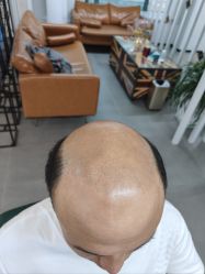 -极客侠男士假发定制补发