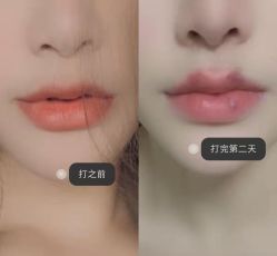 -上海漾颜医疗美容